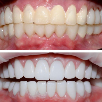 Оксана Прокопенко, Львів Фото - 5