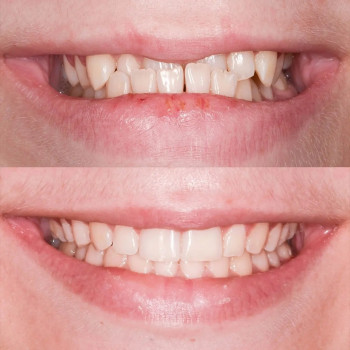 Віталій Пульний, Львів Фото - 5