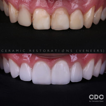 Ярослав Казьо, Львов Фото - 5