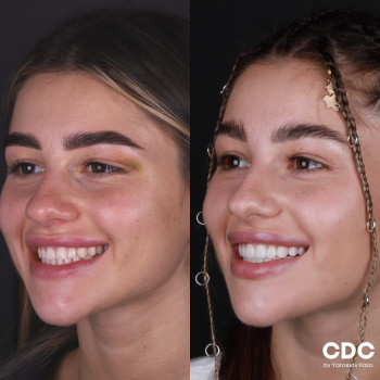 Ярослав Казьо, Львов Фото - 6