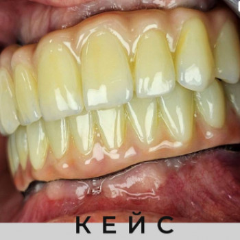 Белая Линия, Николаев Фото - 5