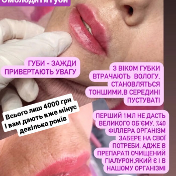 Губи, які хочеться цілувати!
                    Мастер лазерной эпиляции  Васильков