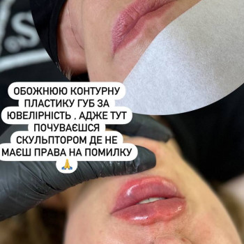 Губи, які хочеться цілувати!
                    Мастер лазерной эпиляции  Васильков