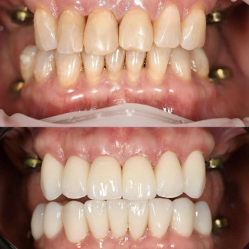 Cheese Dental, Одесса Фото - 5