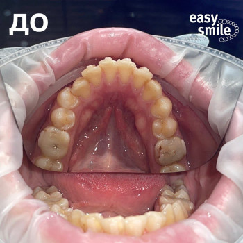 Easy Smile, Одесса Фото - 6