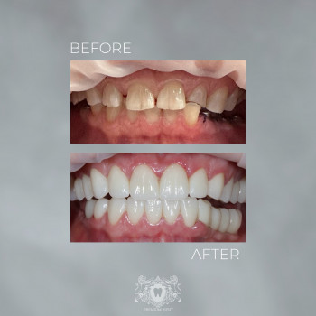 PremiumDent, Одесса Фото - 5