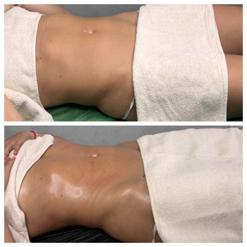 Олена Захарченко, Одеса Фото - 24