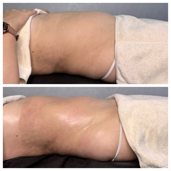 Олена Захарченко, Одеса Фото - 25