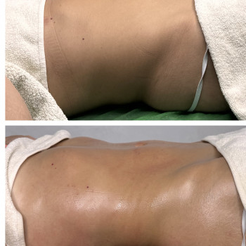 Олена Захарченко, Одеса Фото - 26