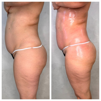 Олена Захарченко, Одеса Фото - 27