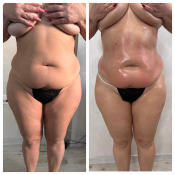 Олена Захарченко, Одеса Фото - 28