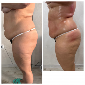 Олена Захарченко, Одеса Фото - 29