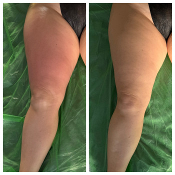 Олена Захарченко, Одеса Фото - 31