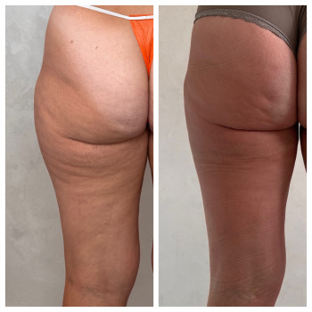 Олена Захарченко, Одеса Фото - 34