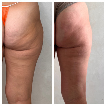 Олена Захарченко, Одеса Фото - 35