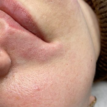 Олеся Багдасарова, Харків Фото - 7