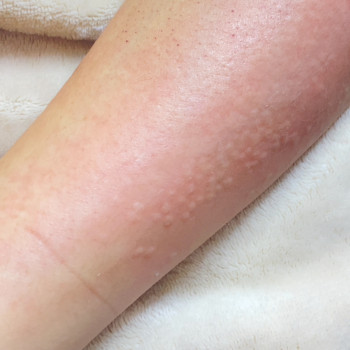 Олеся Багдасарова, Харків Фото - 9