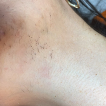 Олеся Багдасарова, Харків Фото - 10