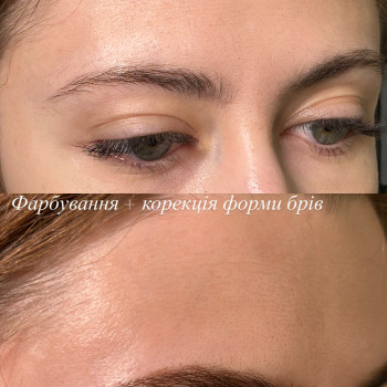 Анастасія Жуковська, Бровары Фото - 6