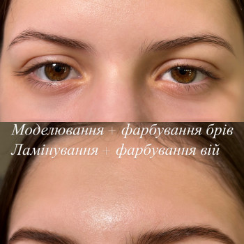 Анастасія Жуковська, Бровары Фото - 11