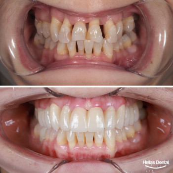 Hellas Dental, Одесса Фото - 5