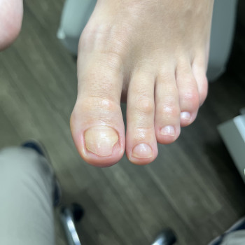 Обробка проблемних нігтів
                    Подолог Дарья Киев