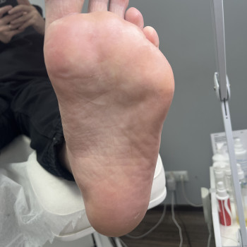 Педикюр
                    Подолог Дарья Киев