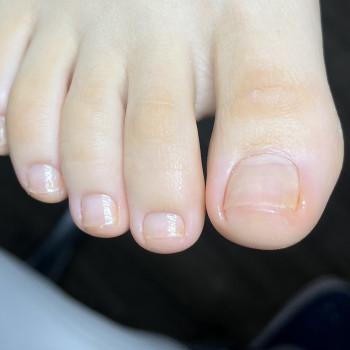 Педикюр
                    Подолог Дарья Киев