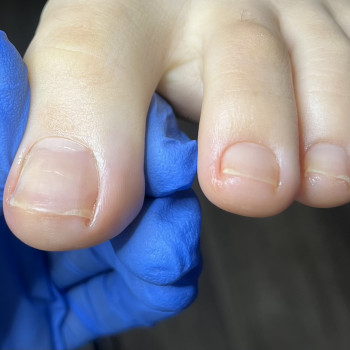 Педикюр
                    Подолог Дарья Киев