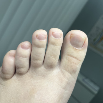 Педикюр
                    Подолог Дарья Киев