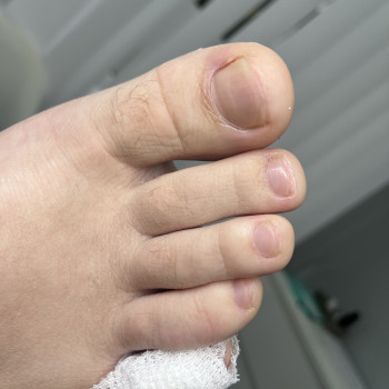 Педикюр
                    Подолог Дарья Киев