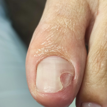 Протезування
                    Центри подології Podo Center Київ