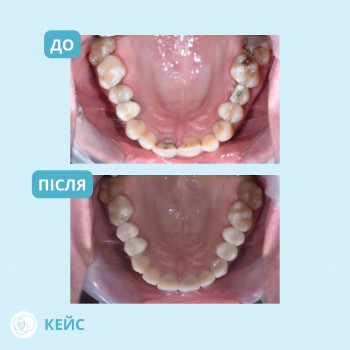 Ортогнатика, Одесса Фото - 5