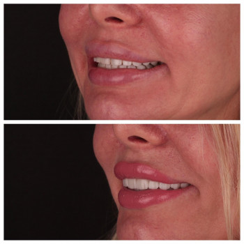 Dental Clinic by Dr.Dymov, Одесса Фото - 5