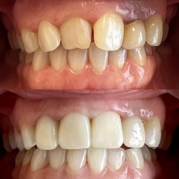 Наталия Чубарова, Одесса Фото - 5