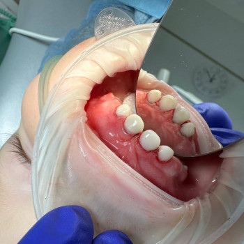 Nikadent, Одесса Фото - 5