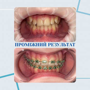 MS Dental Clinic, Одесса Фото - 5