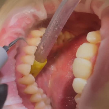 Центр Імплантації, Одеса Фото - 5