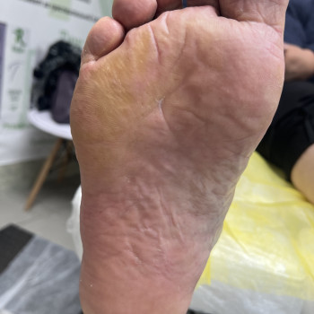 Лікування грибкового ураження
                    Преподаватель курсов красоты Екатерина Запорожье