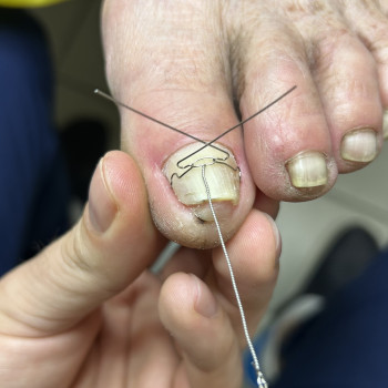 Встановлення корекційних систем
                    Преподаватель курсов красоты Екатерина Запорожье