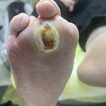 Обробка діабетичної стопи
                    Преподаватель курсов красоты Екатерина Запорожье