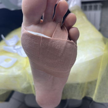 Видалення мозолів
                    Преподаватель курсов красоты Екатерина Запорожье