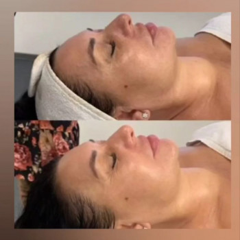   уходовыепроцедуры  
 