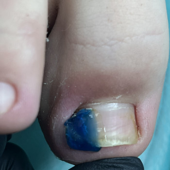 Валентина Линник, Александрия Фото - 5