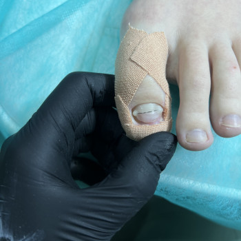 Валентина Линник, Александрия Фото - 6