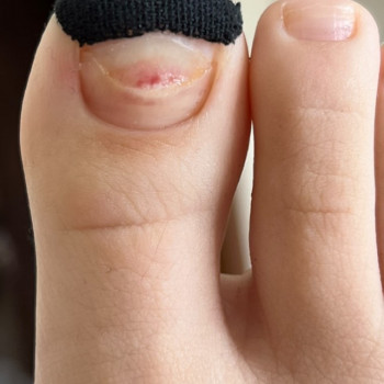 Валентина Линник, Александрия Фото - 7