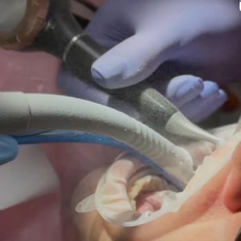 Granat, Одеса Фото - 5