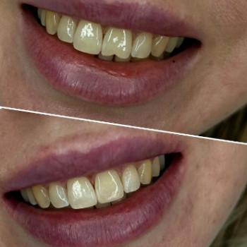 Алина Паталенко, Одесса Фото - 5