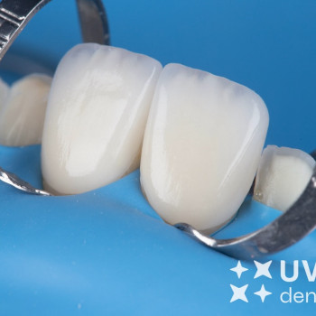 Uvit-dental, Одесса Фото - 5