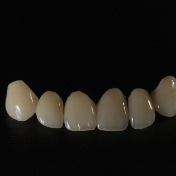 Harmony Dental Clinic, Одесса Фото - 5